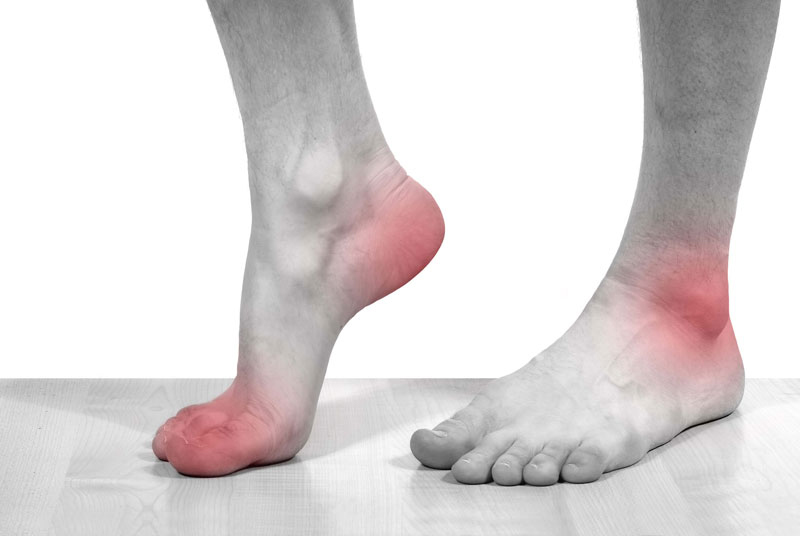 Bệnh gout: Nguyên nhân, biểu hiện và cách điều trị